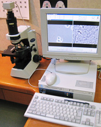 歯周病菌検査顕微鏡の写真