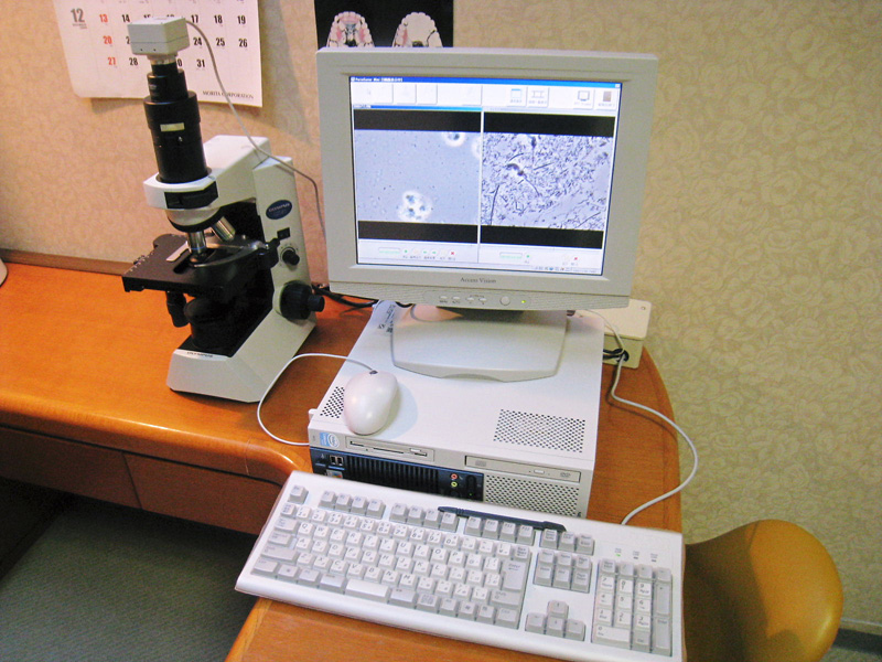 歯周病菌検査顕微鏡